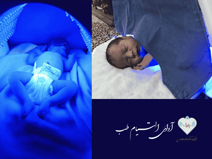 اجاره دستگاه زردی نوزاد در شیراز در منزل مشتری