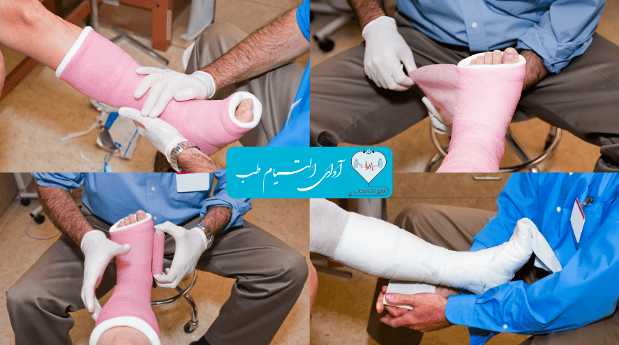 خدمات گچ گیری در منزل در شیراز آوا التیام