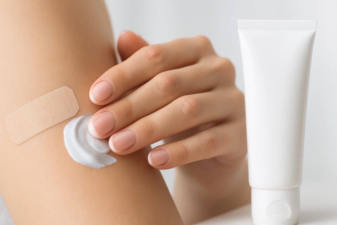 محافظت در برابر تابش مستقیم آفتاب