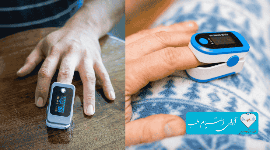 اجاره پالس اکسیمتر انگشتی شیراز